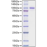 SDS-PAGE - Recombinant Mouse Periostin Protein (C-terminal His Tag) (A331795) - Antibodies.com