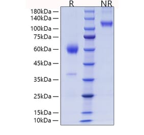 SDS-PAGE - Recombinant Mouse PLGF Protein (C-terminal Human Fc and His Tag) (A331796) - Antibodies.com