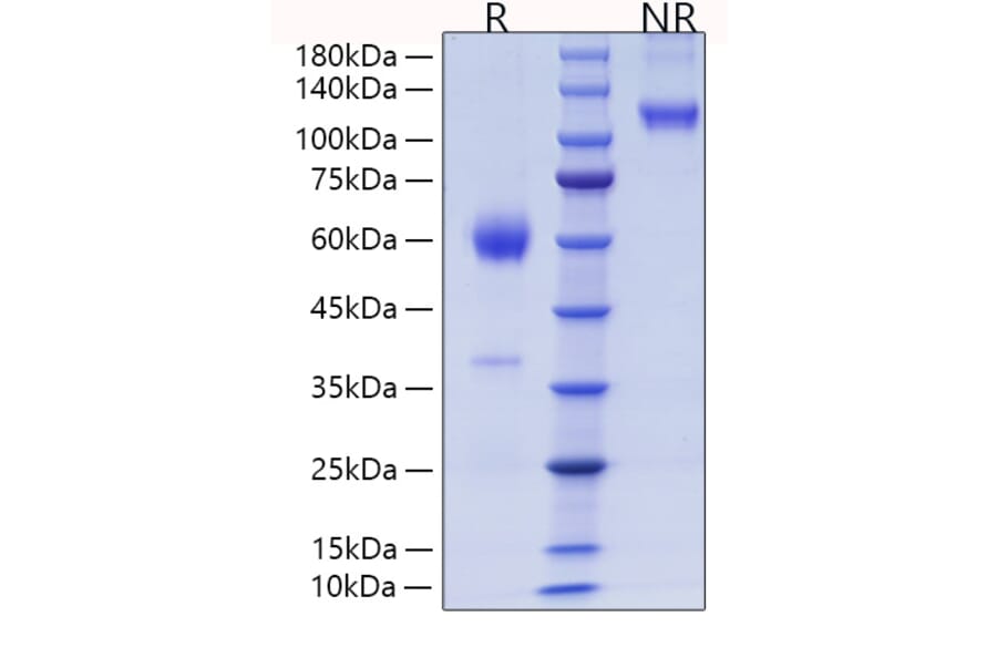 SDS-PAGE - Recombinant Mouse PLGF Protein (C-terminal Human Fc and His Tag) (A331796) - Antibodies.com