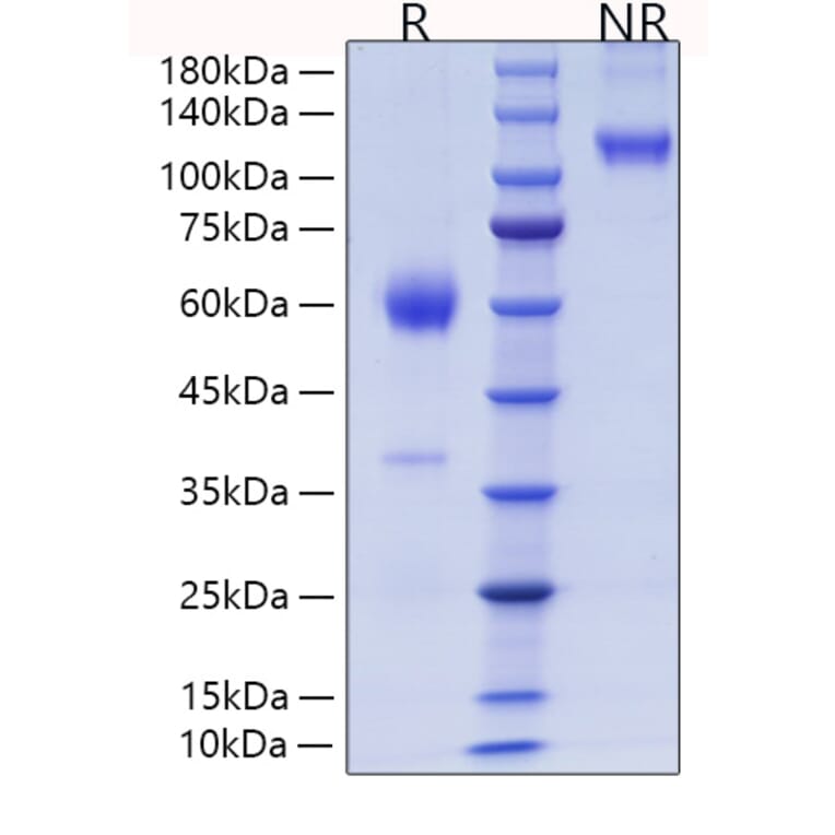 SDS-PAGE - Recombinant Mouse PLGF Protein (C-terminal Human Fc and His Tag) (A331796) - Antibodies.com