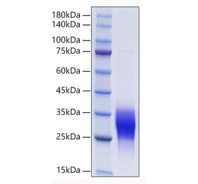 SDS-PAGE - Recombinant Mouse PLGF Protein (C-terminal His and Avi Tag) (A331797) - Antibodies.com