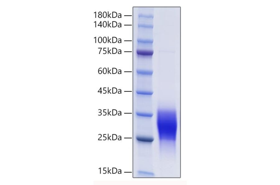 SDS-PAGE - Recombinant Mouse PLGF Protein (C-terminal His and Avi Tag) (A331797) - Antibodies.com