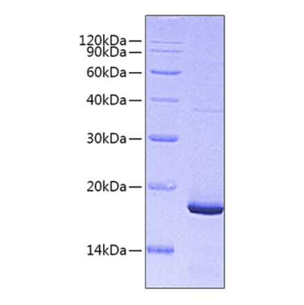 SDS-PAGE - Recombinant Mouse PTN Protein (C-terminal His Tag) (A331798) - Antibodies.com