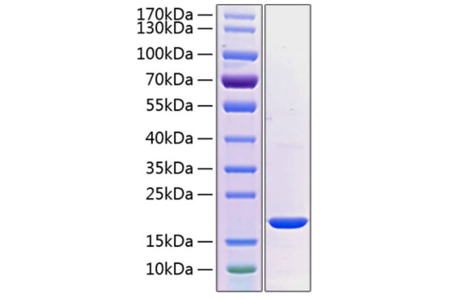 SDS-PAGE - Recombinant Human PRL-2 Protein (C-terminal His Tag) (A331799) - Antibodies.com