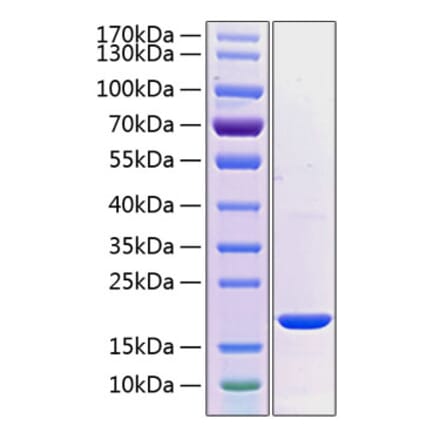 SDS-PAGE - Recombinant Human PRL-2 Protein (C-terminal His Tag) (A331799) - Antibodies.com