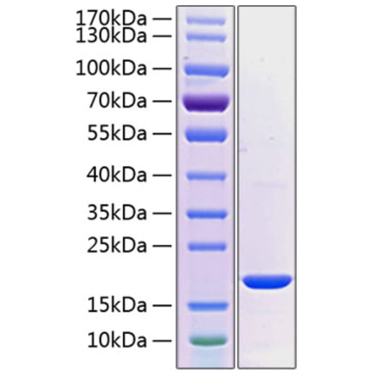 SDS-PAGE - Recombinant Human PRL-2 Protein (C-terminal His Tag) (A331799) - Antibodies.com