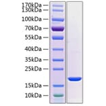 SDS-PAGE - Recombinant Human PRL-2 Protein (C-terminal His Tag) (A331799) - Antibodies.com