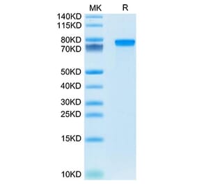 SDS-PAGE - Recombinant Mouse Progranulin Protein (C-terminal His Tag) (A331800) - Antibodies.com