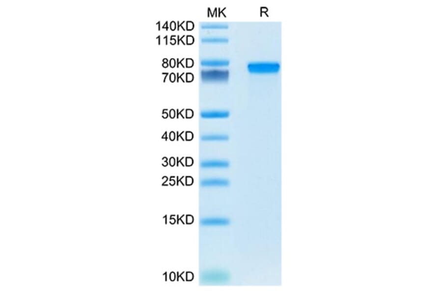 SDS-PAGE - Recombinant Mouse Progranulin Protein (C-terminal His Tag) (A331800) - Antibodies.com