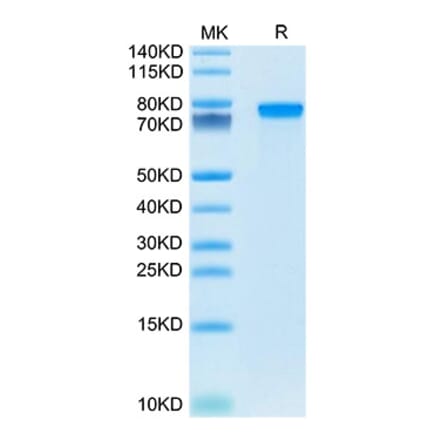 SDS-PAGE - Recombinant Mouse Progranulin Protein (C-terminal His Tag) (A331800) - Antibodies.com