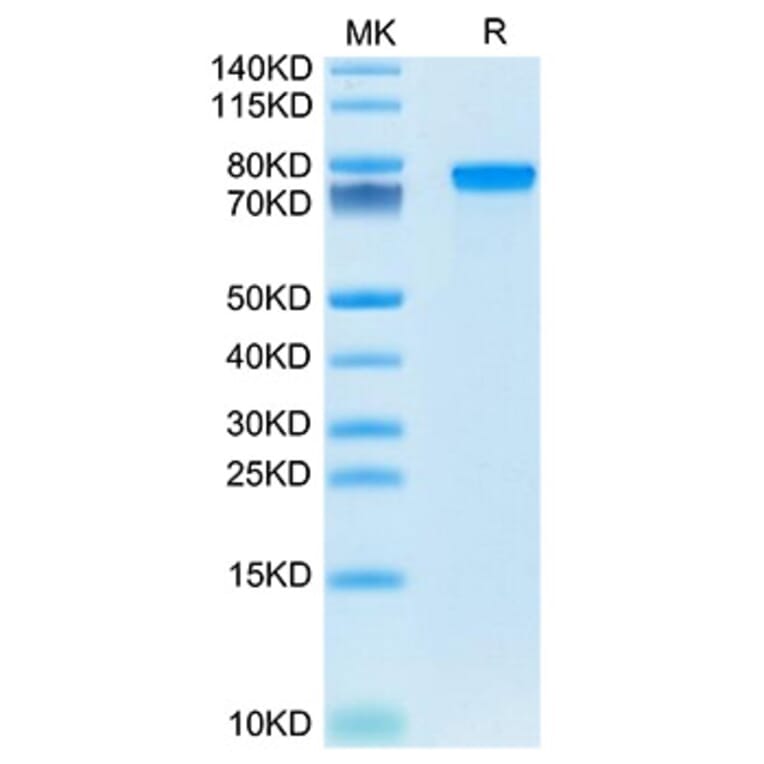 SDS-PAGE - Recombinant Mouse Progranulin Protein (C-terminal His Tag) (A331800) - Antibodies.com
