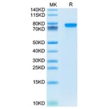 SDS-PAGE - Recombinant Mouse Progranulin Protein (C-terminal His Tag) (A331800) - Antibodies.com