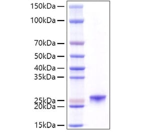 SDS-PAGE - Recombinant Mouse Prolactin Protein (C-terminal His Tag) (A331801) - Antibodies.com
