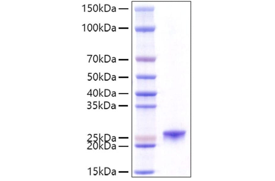SDS-PAGE - Recombinant Mouse Prolactin Protein (C-terminal His Tag) (A331801) - Antibodies.com