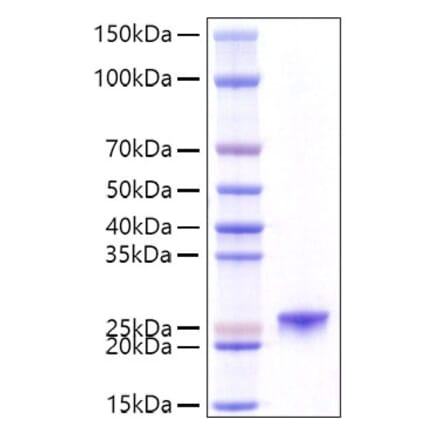 SDS-PAGE - Recombinant Mouse Prolactin Protein (C-terminal His Tag) (A331801) - Antibodies.com