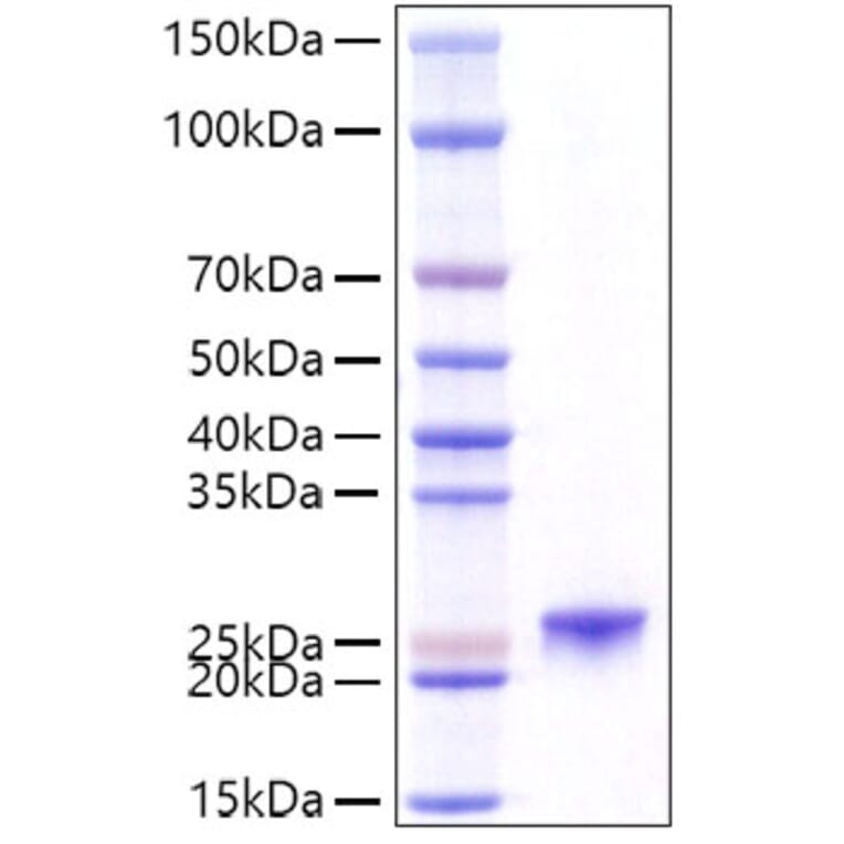 SDS-PAGE - Recombinant Mouse Prolactin Protein (C-terminal His Tag) (A331801) - Antibodies.com