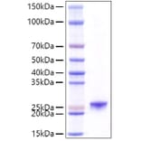 SDS-PAGE - Recombinant Mouse Prolactin Protein (C-terminal His Tag) (A331801) - Antibodies.com
