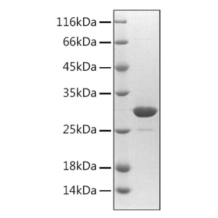 SDS-PAGE - Recombinant Mouse PTGDS Protein (C-terminal His Tag) (A331802) - Antibodies.com