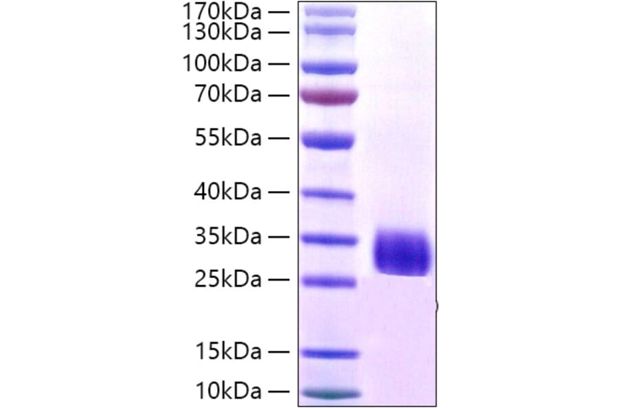 SDS-PAGE - Recombinant Staphylococcus aureus Protein A Protein (A331803) - Antibodies.com