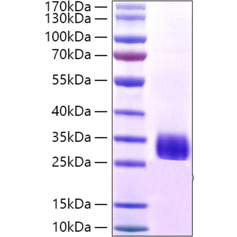 SDS-PAGE - Recombinant Staphylococcus aureus Protein A Protein (A331803) - Antibodies.com