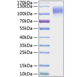 SDS-PAGE - Recombinant Mouse CD62P Protein (C-terminal His Tag) (A331805) - Antibodies.com