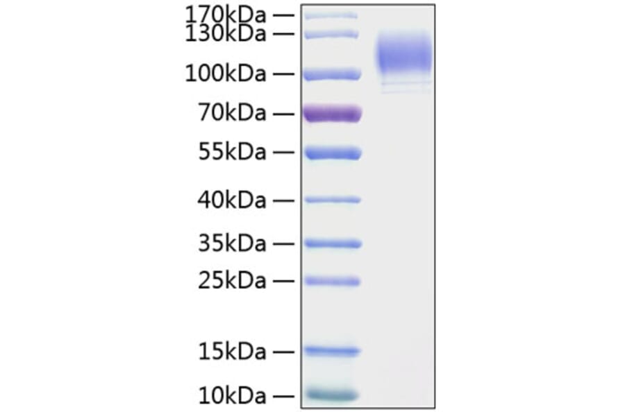 SDS-PAGE - Recombinant Mouse CD62P Protein (C-terminal His Tag) (A331805) - Antibodies.com