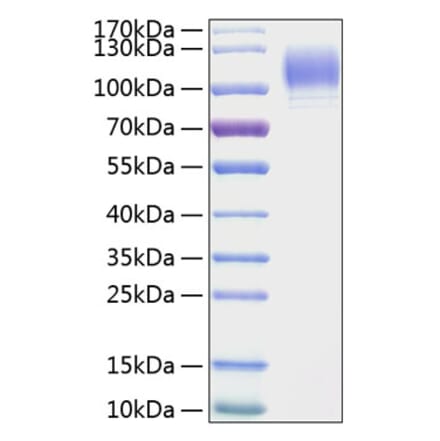 SDS-PAGE - Recombinant Mouse CD62P Protein (C-terminal His Tag) (A331805) - Antibodies.com