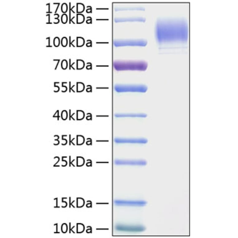 SDS-PAGE - Recombinant Mouse CD62P Protein (C-terminal His Tag) (A331805) - Antibodies.com