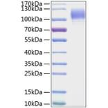 SDS-PAGE - Recombinant Mouse CD62P Protein (C-terminal His Tag) (A331805) - Antibodies.com