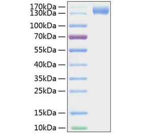SDS-PAGE - Recombinant Mouse CD62P Protein (C-terminal Human Fc and His Tag) (A331806) - Antibodies.com