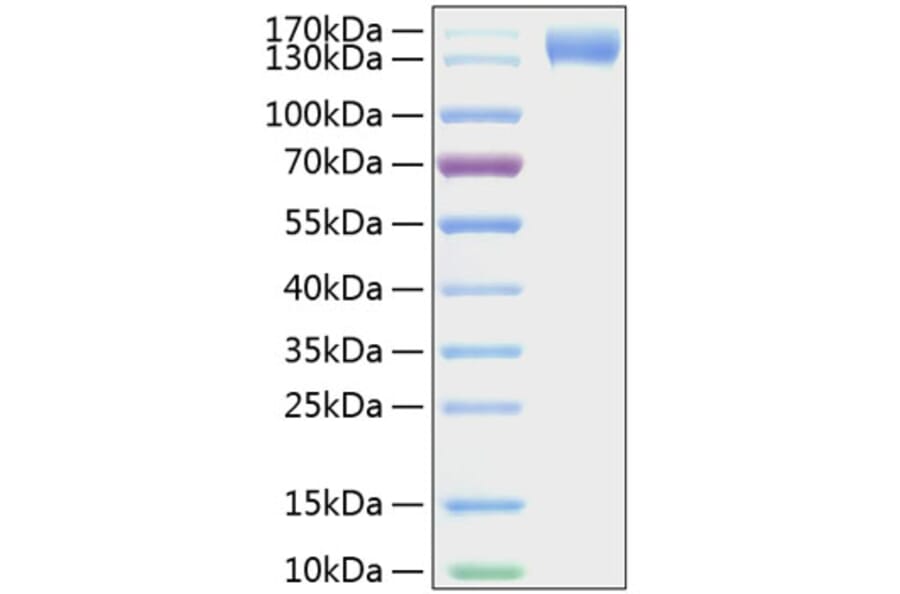 SDS-PAGE - Recombinant Mouse CD62P Protein (C-terminal Human Fc and His Tag) (A331806) - Antibodies.com
