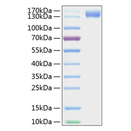 SDS-PAGE - Recombinant Mouse CD62P Protein (C-terminal Human Fc and His Tag) (A331806) - Antibodies.com