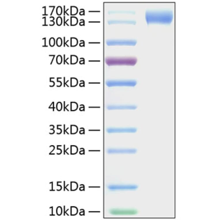 SDS-PAGE - Recombinant Mouse CD62P Protein (C-terminal Human Fc and His Tag) (A331806) - Antibodies.com