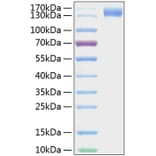 SDS-PAGE - Recombinant Mouse CD62P Protein (C-terminal Human Fc and His Tag) (A331806) - Antibodies.com