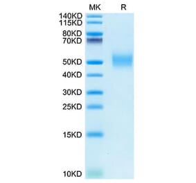 Tris-Bis PAGE - Recombinant Rhesus macaque PVR Protein (C-terminal His Tag) (A331807) - Antibodies.com