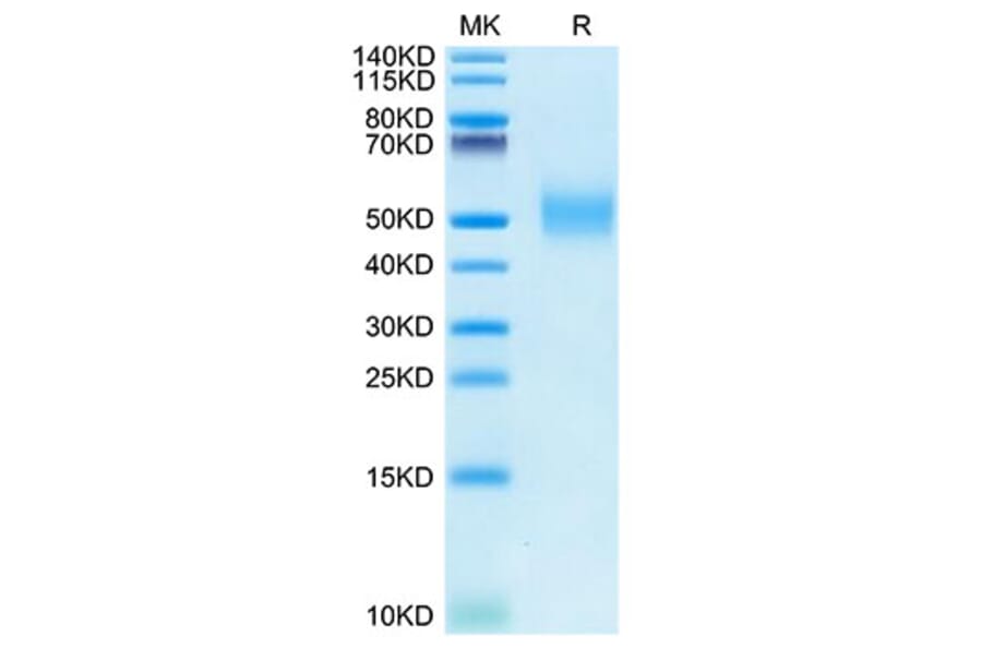 Tris-Bis PAGE - Recombinant Rhesus macaque PVR Protein (C-terminal His Tag) (A331807) - Antibodies.com