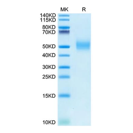 Tris-Bis PAGE - Recombinant Rhesus macaque PVR Protein (C-terminal His Tag) (A331807) - Antibodies.com