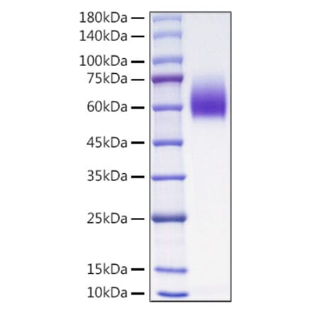 SDS-PAGE - Recombinant Mouse PVR Protein (C-terminal His Tag) (A331809) - Antibodies.com