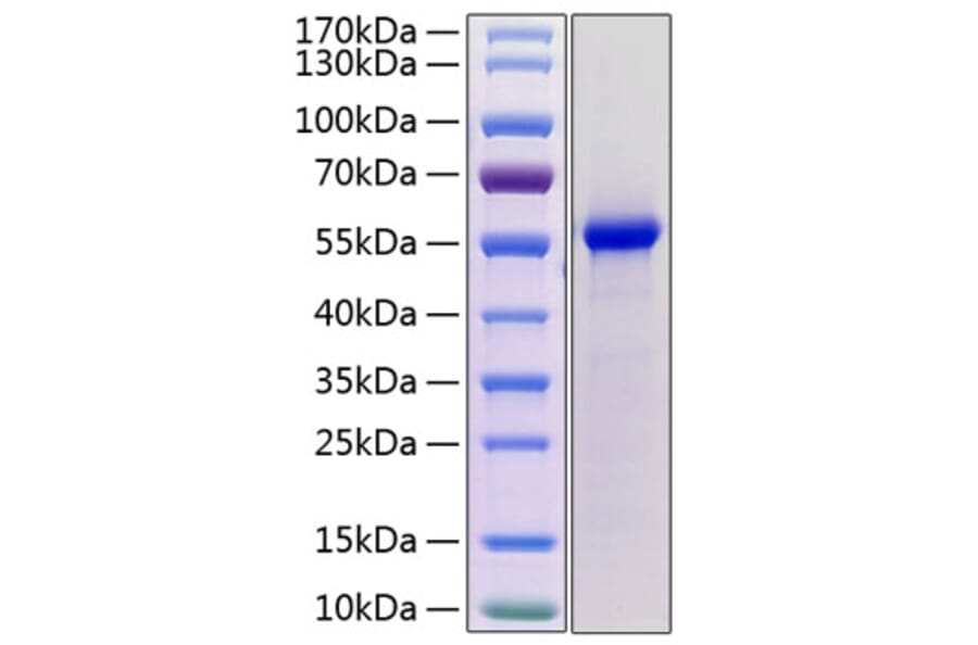 SDS-PAGE - Recombinant Mouse Renin 1 Protein (C-terminal His Tag) (A331810) - Antibodies.com