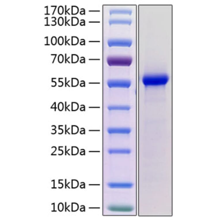 SDS-PAGE - Recombinant Mouse Renin 1 Protein (C-terminal His Tag) (A331810) - Antibodies.com