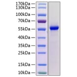 SDS-PAGE - Recombinant Mouse Renin 1 Protein (C-terminal His Tag) (A331810) - Antibodies.com