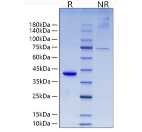 SDS-PAGE - Recombinant Mouse RETN Protein (N-terminal Human Fc Tag) (A331811) - Antibodies.com