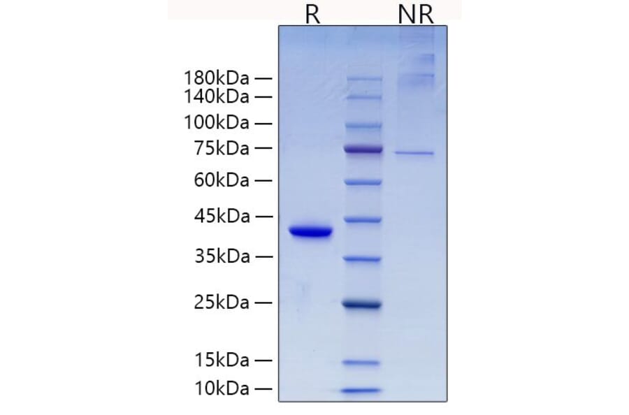 SDS-PAGE - Recombinant Mouse RETN Protein (N-terminal Human Fc Tag) (A331811) - Antibodies.com