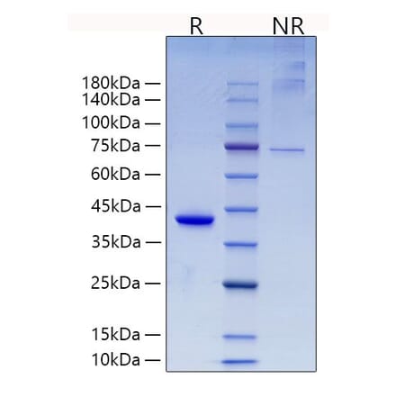 SDS-PAGE - Recombinant Mouse RETN Protein (N-terminal Human Fc Tag) (A331811) - Antibodies.com