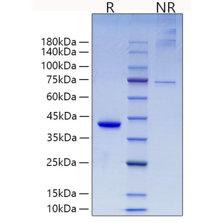 SDS-PAGE - Recombinant Mouse RETN Protein (N-terminal Human Fc Tag) (A331811) - Antibodies.com