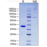 SDS-PAGE - Recombinant Mouse RETN Protein (N-terminal Human Fc Tag) (A331811) - Antibodies.com