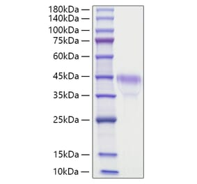 SDS-PAGE - Recombinant Mouse RSPO1 Protein (C-terminal His Tag) (A331812) - Antibodies.com