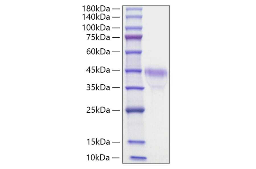 SDS-PAGE - Recombinant Mouse RSPO1 Protein (C-terminal His Tag) (A331812) - Antibodies.com