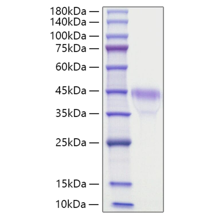 SDS-PAGE - Recombinant Mouse RSPO1 Protein (C-terminal His Tag) (A331812) - Antibodies.com