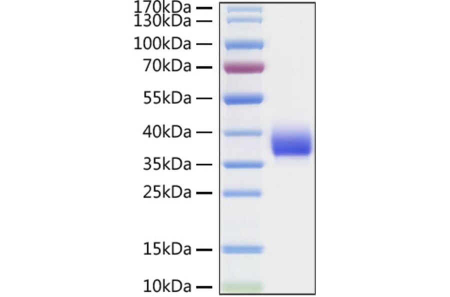 SDS-PAGE - Recombinant SARS-CoV Spike RBD Protein (C-terminal His Tag) (A331815) - Antibodies.com